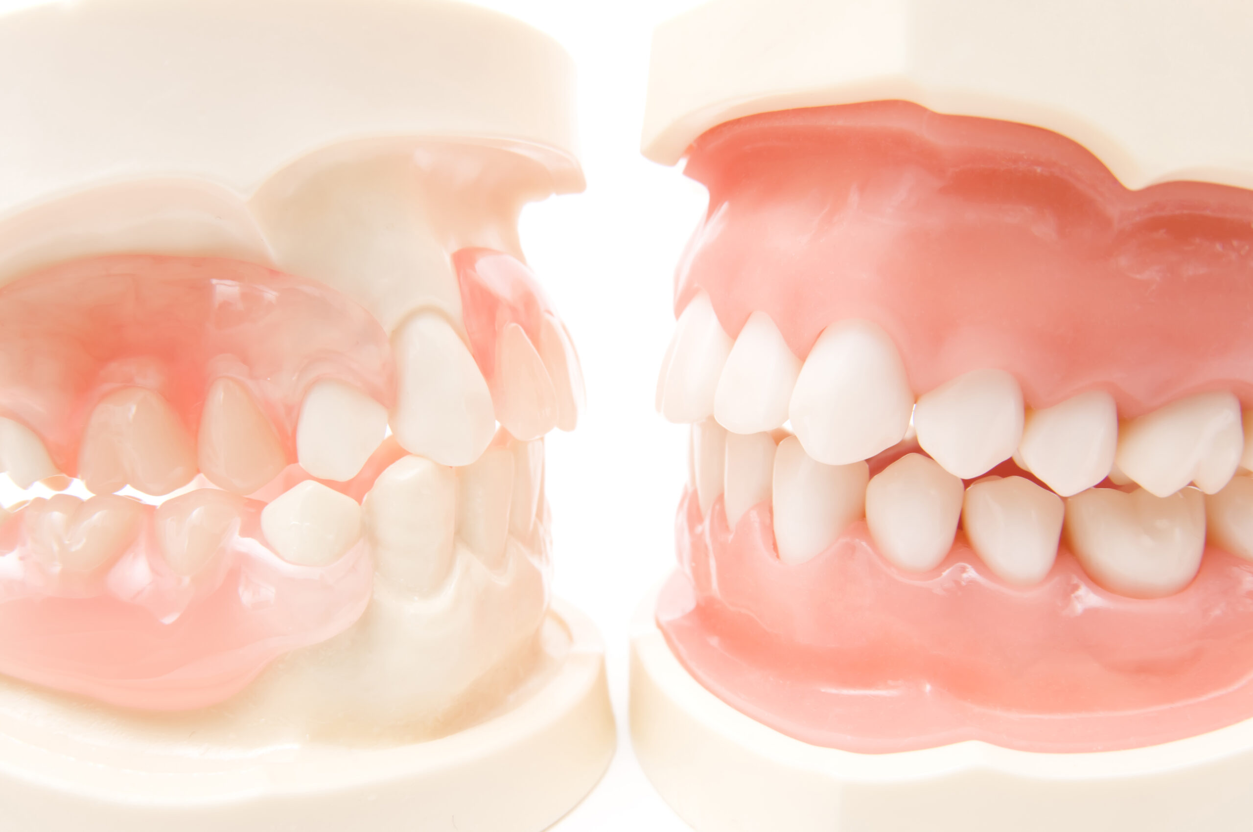 保険診療、自由診療から選べる。総入れ歯の種類と特徴